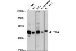 Western blot analysis of extracts of various cell lines, using PARVB antibody (ABIN6127617, ABIN6145244, ABIN6145245 and ABIN6217054) at 1:3000 dilution. (Parvin, beta antibody  (AA 1-100))