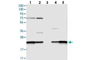 Western blot analysis of Lane 1: RT-4, Lane 2: U-251 MG, Lane 3: Human Plasma, Lane 4: Liver, Lane 5: Tonsil with SPCS2 polyclonal antibody  at 1:250-1:500 dilution.