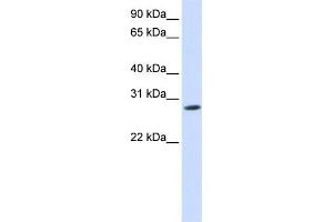WB Suggested Anti-KCNIP4 Antibody Titration:  0.