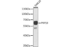 Western blot analysis of extracts of SW620 cells, using PRP19 antibody (ABIN6132439, ABIN6146257, ABIN6146259 and ABIN6222419) at 1:1000 dilution. (PRP19 antibody  (AA 1-220))