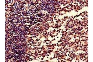 Immunohistochemistry of paraffin-embedded human tonsil tissue using ABIN7148409 at dilution of 1:100 (CD35 antibody  (AA 901-1095))