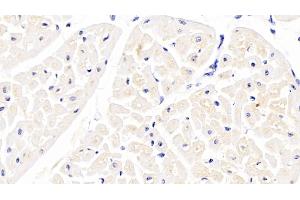 Detection of APOB100 in Bovine Cardiac Muscle Tissue using Polyclonal Antibody to Apolipoprotein B100 (APOB100)