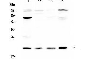 Western blot analysis of Kallikrein 2  using anti-Kallikrein 2  antibody . (Kallikrein 2 antibody  (AA 25-261))