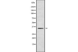 Western blot analysis of PLSCR2 using HuvEc whole cell lysates (PLSCR2 antibody  (Internal Region))