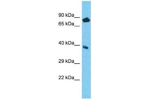 Host: Rabbit Target Name: NPEPL1 Sample Type: ACHN Whole Cell lysates Antibody Dilution: 1. (NPEPL1 antibody  (N-Term))