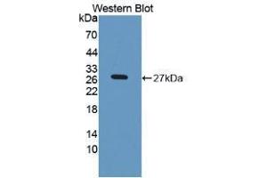Western blot analysis of recombinant Rat LPO. (LPO antibody  (AA 351-589))