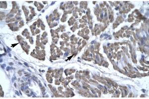 Human Skeletal Muscle (EYA3 antibody  (Middle Region))