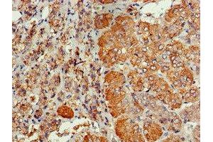 Immunohistochemistry of paraffin-embedded human adrenal gland tissue using ABIN7147287 at dilution of 1:100 (CDC6 antibody  (AA 1-141))
