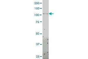 TLR8 monoclonal antibody (M01), clone 4C6 Western Blot analysis of TLR8 expression in HL-60 . (TLR8 antibody  (AA 723-825))