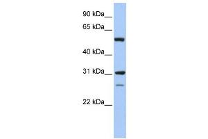Western Blotting (WB) image for anti-Inosine 5'-Phosphate Dehydrogenase 1 (IMPDH1) antibody (ABIN2459738) (IMPDH1 antibody)