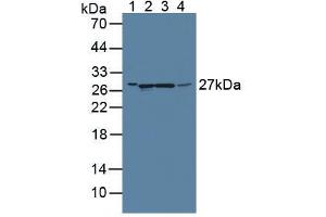 Western blot analysis of (1) Rat Serum, (2) Rat Liver Tissue, (3) Rat Pancreas Tissue and (4) Rat Kidney Tissue. (GAMT antibody  (AA 2-236))