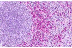 Anti-S1PR4 / EDG6 antibody IHC staining of human spleen. (S1PR4 antibody  (Cytoplasmic Domain))