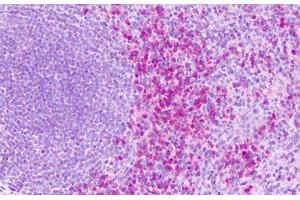Anti-S1PR4 / EDG6 antibody IHC staining of human spleen. (S1PR4 antibody  (Cytoplasmic Domain))