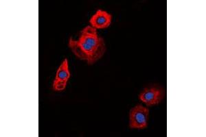 Immunofluorescent analysis of Collagen 20 alpha 1 staining in HT29 cells.