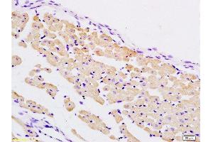 Formalin-fixed and paraffin embedded rat heart tissue labeled with Anti-PER2/Period circadian protein 2 Polyclonal Antibody, Unconjugated  at 1:200 followed by conjugation to the secondary antibody and DAB staining (PER2 antibody  (AA 751-850))