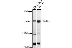 Western blot analysis of extracts of various cell lines, using SETD5 antibody (ABIN6132960, ABIN6147644, ABIN6147646 and ABIN6223140) at 1:1000 dilution. (SETD5 antibody  (AA 520-740))