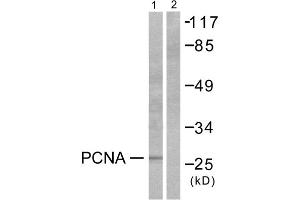 Western blot analysis of extracts from HepG2 cells, using PCNA antibody (ABIN5976487). (PCNA antibody  (Internal Region))