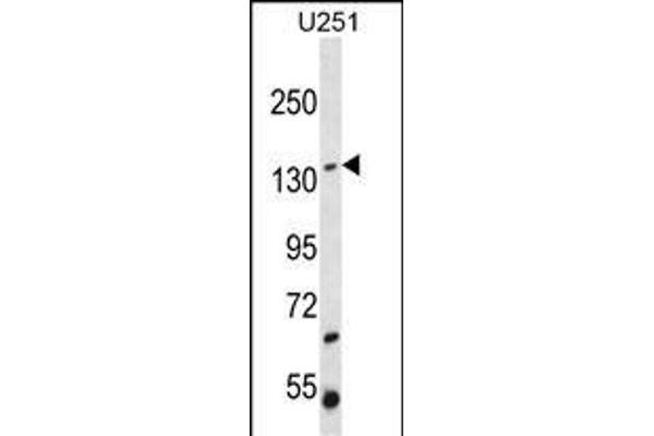 ST5 anticorps  (C-Term)
