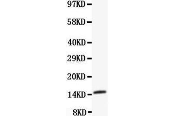 FABP3 antibody  (C-Term)