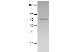 Western Blotting (WB) image for NLR Family, Pyrin Domain Containing 3 (NLRP3) (AA 5-218) protein (His-IF2DI Tag) (ABIN7124184) (NLRP3 Protein (AA 5-218) (His-IF2DI Tag))