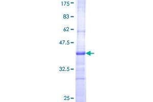CILP Protein (AA 129-226) (GST tag)