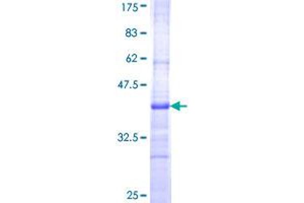 CILP Protein (AA 129-226) (GST tag)