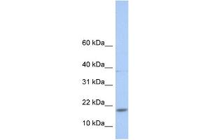 WB Suggested Anti-MAX Antibody Titration:  0. (MAX antibody  (N-Term))