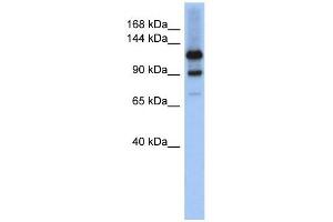 HIPK1 antibody used at 1 ug/ml to detect target protein.