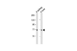 All lanes : Anti-MUC20 Antibody (N-term) at 1:2000 dilution Lane 1: Human kidney whole lysate Lane 2: Human liver whole lysate Lysates/proteins at 20 μg per lane. (MUC20 antibody  (N-Term))