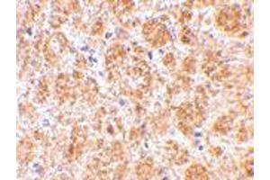 Immunohistochemistry of DARC in mouse brain tissue with DARC polyclonal antibody  at 2.