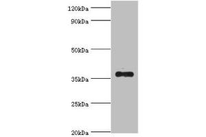 Western blot All lanes: AKR1B10 antibody at 4 μg/mL + A549 whole cell lysate Secondary Goat polyclonal to rabbit IgG at 1/10000 dilution Predicted band size: 36 kDa Observed band size: 36 kDa (AKR1B1 antibody  (AA 1-316))