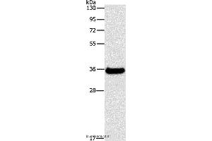 Western blot analysis of Human fetal liver tissue, using FGL1 Polyclonal Antibody at dilution of 1:500