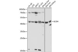 Western blot analysis of extracts of various cell lines, using GCDH antibody (ABIN6132101, ABIN6141009, ABIN6141010 and ABIN6224875) at 1:1000 dilution. (GCDH antibody  (AA 149-438))