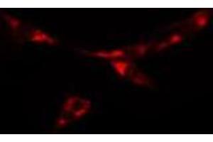 ABIN6277886 staining  NIH-3T3 cells by IF/ICC. (PKD2 antibody  (N-Term))