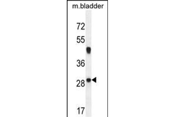 NCALD antibody  (C-Term)