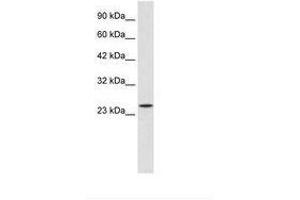 Zinc Finger Protein 22 antibody  (C-Term)