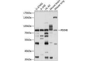 Western blot analysis of extracts of various cell lines, using PDE4B antibody (ABIN6132469, ABIN6145350, ABIN6145351 and ABIN6214353) at 1:1000 dilution. (PDE4B antibody  (AA 1-130))
