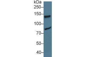 Western Blot; Sample: Human Jurkat cell lysate; Primary Ab: 3µg/ml Rabbit Anti-Rat LIG1 Antibody Second Ab: 0.