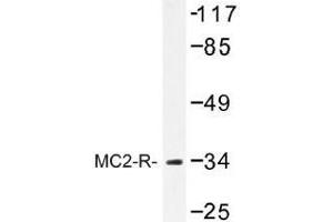 Image no. 1 for anti-Melanocortin 2 Receptor (Adrenocorticotropic Hormone) (MC2R) antibody (ABIN317741) (MC2R antibody)