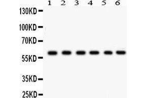 Western Blotting (WB) image for anti-Cytochrome P450, Family 24, Subfamily A, Polypeptide 1 (CYP24A1) (AA 153-514) antibody (ABIN3042784) (CYP24A1 antibody  (AA 153-514))