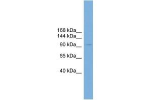 Human HT1080; WB Suggested Anti-PIWIL4 Antibody Titration: 0.