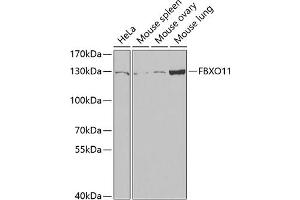 Western blot analysis of extracts of various cell lines, using FBXO11 antibody (ABIN6130885, ABIN6140512, ABIN6140513 and ABIN6221761) at 1:1000 dilution.