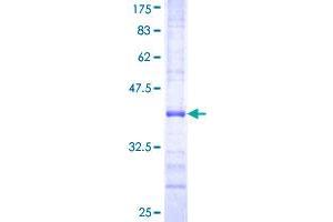 MCM2 Protein (AA 805-904) (GST tag)