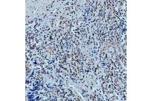 Immunohistochemical analysis of 42278 staining in human tonsil formalin fixed paraffin embedded tissue section.