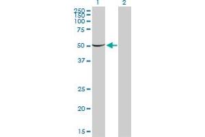 Western Blot analysis of PGM1 expression in transfected 293T cell line by PGM1 monoclonal antibody (M01), clone 3B8-H4. (Phosphoglucomutase 1 antibody  (AA 1-562))