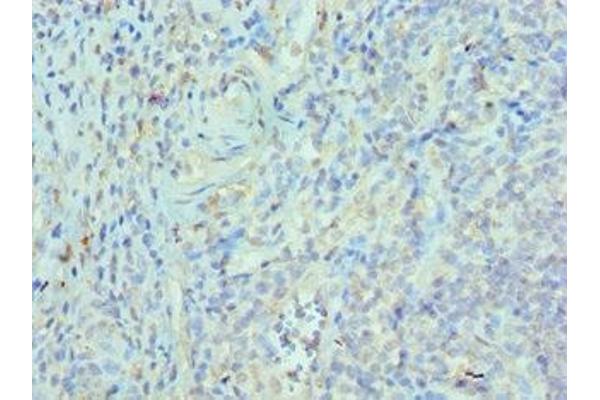 ETV6 antibody  (AA 1-300)