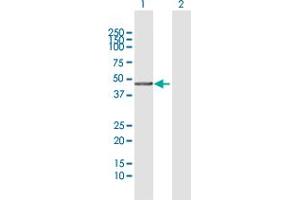 Western Blotting (WB) image for anti-DNA (Cytosine-5-)-Methyltransferase 3 Like (TRDMT1) (AA 1-386) antibody (ABIN526180)