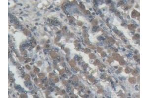Immunohistochemistry (IHC) image for anti-Amiloride Binding Protein 1 (Amine Oxidase (Copper-Containing)) (ABP1) (AA 210-301) antibody (ABIN7437725)