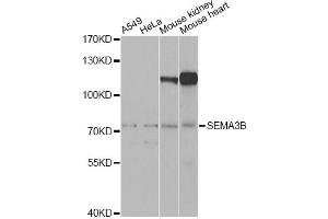 Western blot analysis of extracts of various cell lines, using SEMA3B Antibody (ABIN2559860) at 1:1000 dilution. (SEMA3B antibody)