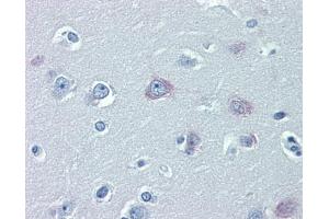 Immunohistochemistry (IHC) image for anti-Transient Receptor Potential Cation Channel, Subfamily M, Member 2 (TRPM2) (N-Term) antibody (ABIN2781840) (TRPM2 antibody  (N-Term))